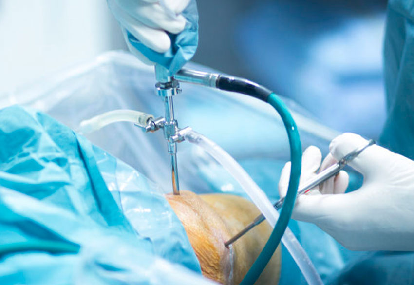 Orthopedics Orthopedics