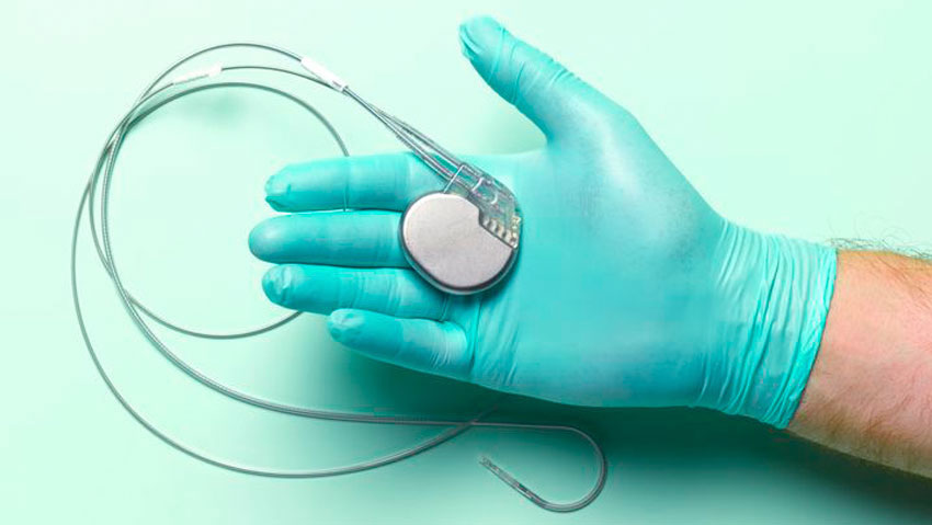 Reasons for Pacemaker Implantation Reasons for Pacemaker Implantation